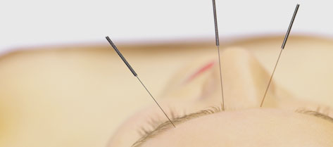 Acupuncture Morley Galleria